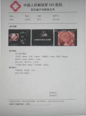 kg/jw-170醫用干式膠片