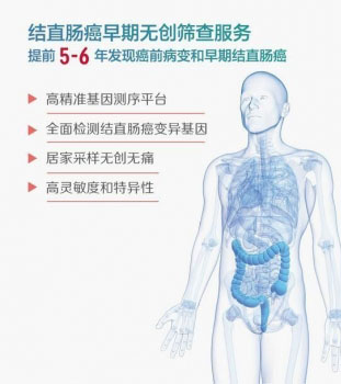 常易舒?—結直腸癌早期無創基因檢測