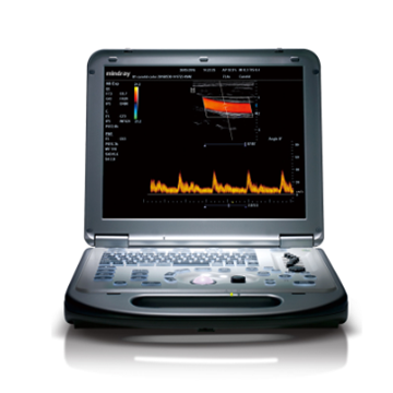 邁瑞mindray 便攜式彩色多普勒超聲系統(tǒng) m55(主機(jī)+線(xiàn)陣+腹部+相控陣)