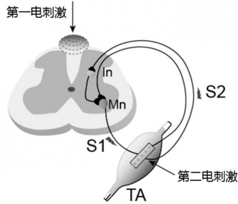 體外脊髓神經(jīng)刺激測(cè)試系統(tǒng)3599