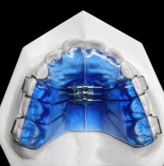 華偉定制式矯治器擴弓型、矯治保持型、牙膠片型