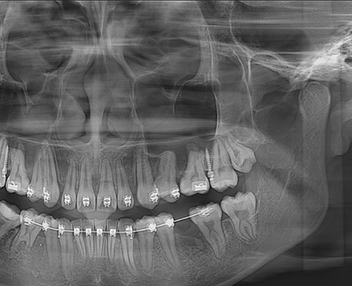 美亞光電mydentviewer口腔醫學影像處理軟件