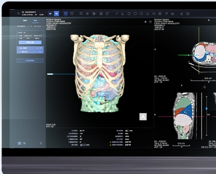 海杰亞hyvision-liverctlite肝臟ct影像處理軟件