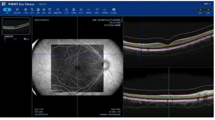 眼底病變眼底圖像輔助診斷軟件mcs（云服務(wù)器版）